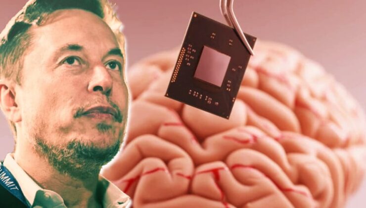 Elon Musk’ın İnsan Beynine Çip Takacak “Neuralink” Projesi İçin Ne Kadar Yatırım Topladığı Ortaya Çıktı