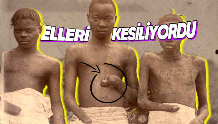 Hitler’den Daha Fazla İnsan Öldürmesine Karşın Onun Kadar Bilinmeyen Acımasız Diktatör: II. Leopold