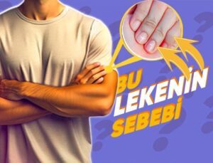 Son Vakitlerde Yemek Yemekten Bile Soğuduysanız Sebebi Bu Olabilir: ‘Çinko Eksikliği’ Nedir, Neden Olur, Belirtileri Nelerdir?