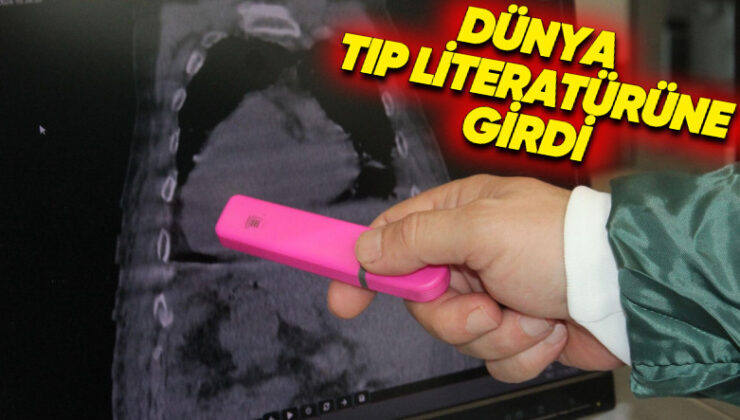 Giresun’da Dünyada Birinci Defa Görülen Bir Hastalık Keşfedildi: “Giresun Sendromu” Olarak Tıp Literatürüne Girdi!