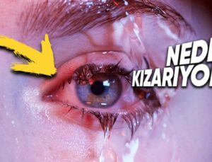 Havuzdayken Gözlerimizin Kırmızıya Dönmesinin Artık Girerken İki Sefer Düşündürecek Sebebi