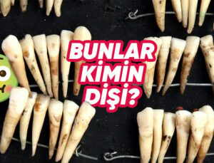 Mide Kaldırır!: Eski Vakitlerde Protez Dişlerin ve Diş Beyazlatmanın Nasıl Yapıldığını Öğrenince Günümüz Teknolojisine Bir Defa Daha Teşekkür Edeceksiniz